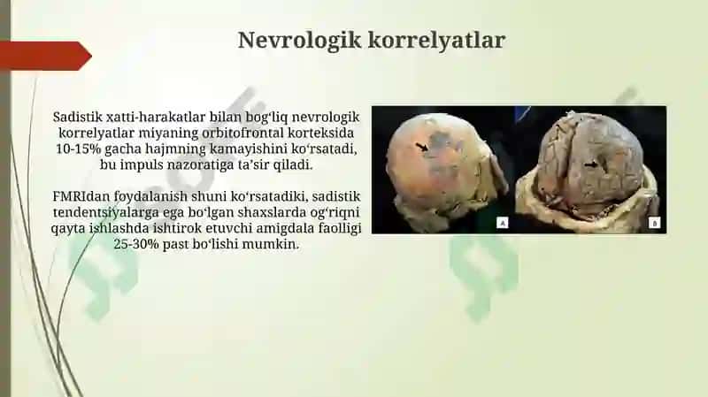 Xomiladorlik patalogiyasi 5