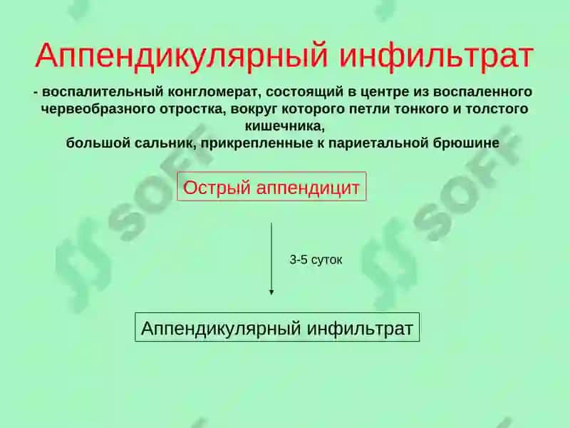 Осложнения острого аппендицита 5