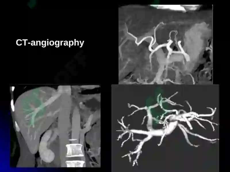 IMAGING OF LIVER DISEASES 6