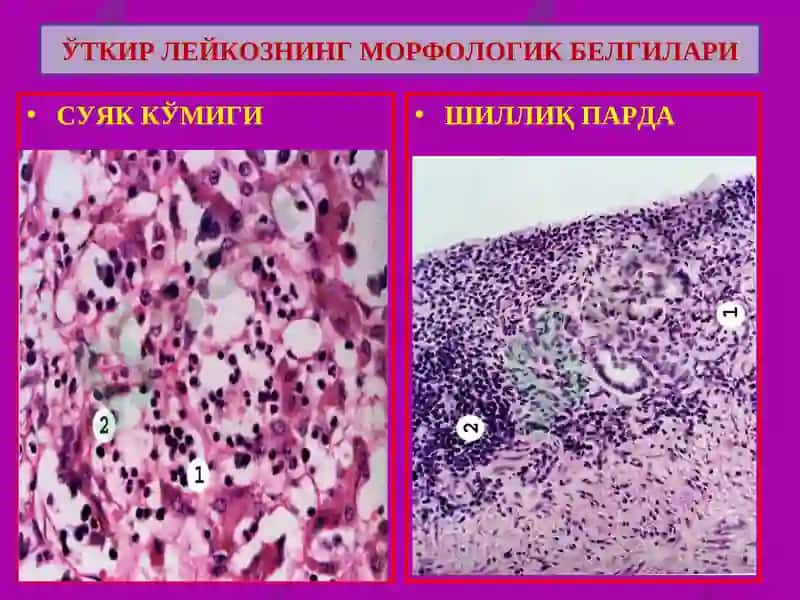 ПАТОЛОГИК АНАТОМИЯ 6