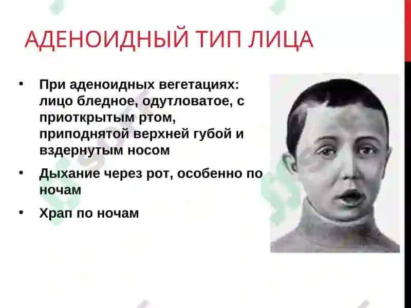 Пропедевтика детских болезней 6