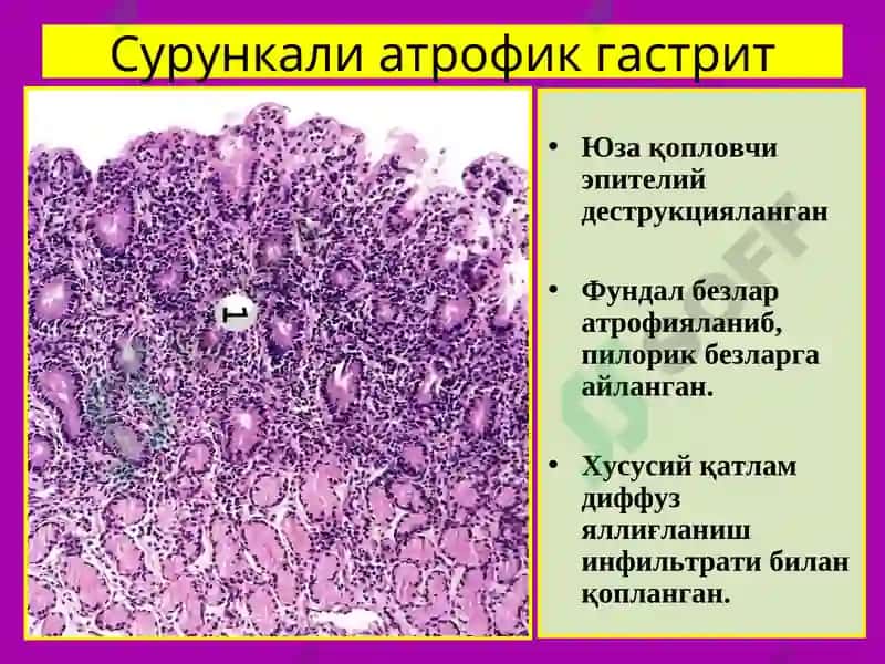 ПАТОЛОГИК АНАТОМИЯ 6