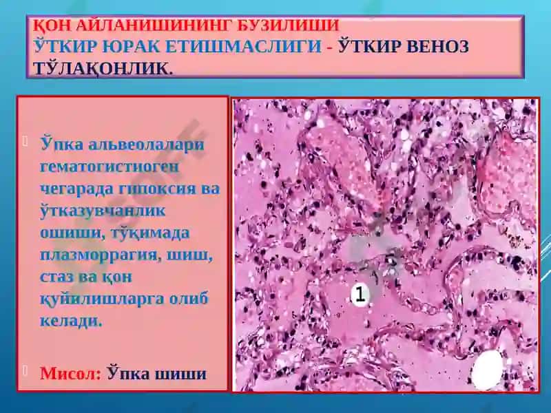 ПАТОЛОГИК АНАТОМИЯ 6