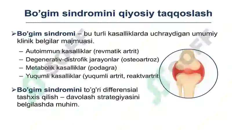 Bo’g’im sindromi haqida ma’lumot 6