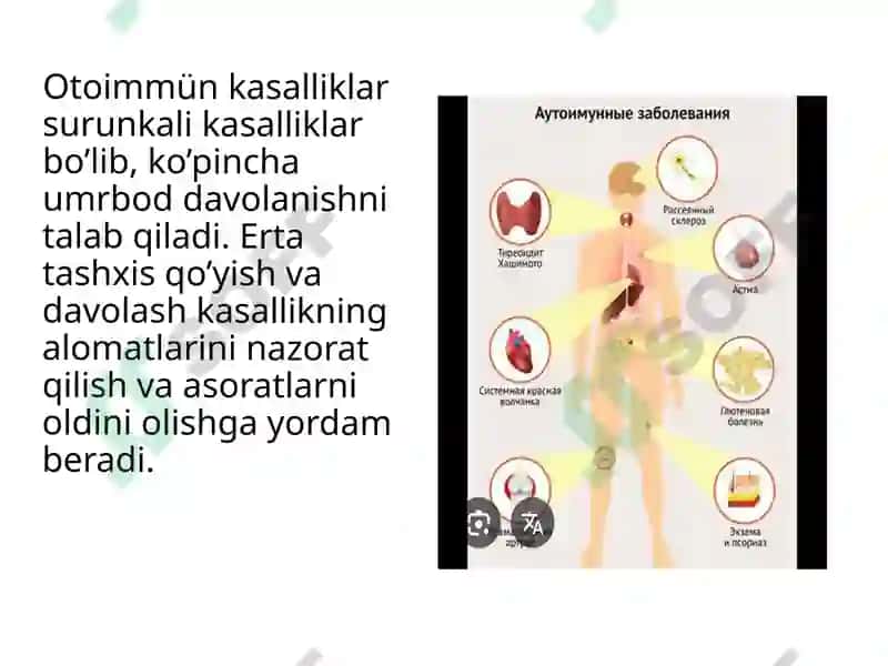Autoimmun kasalliklar kelib chiqishi, profilaktikasi va diagnostika 6