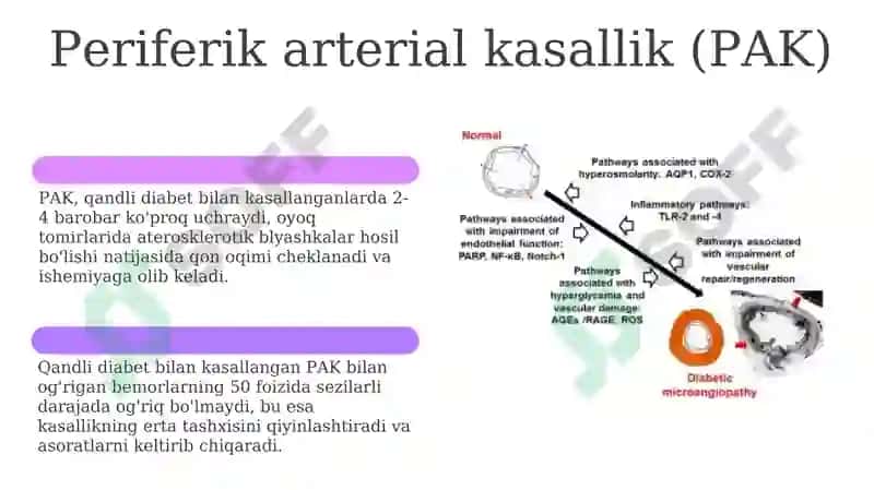 Diabetik Makroangiopatiyalar 6