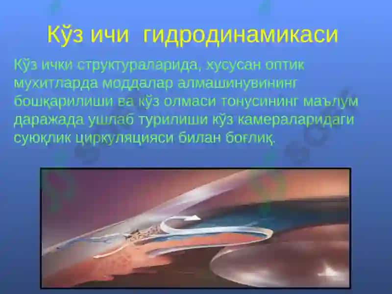 Глаукома 6