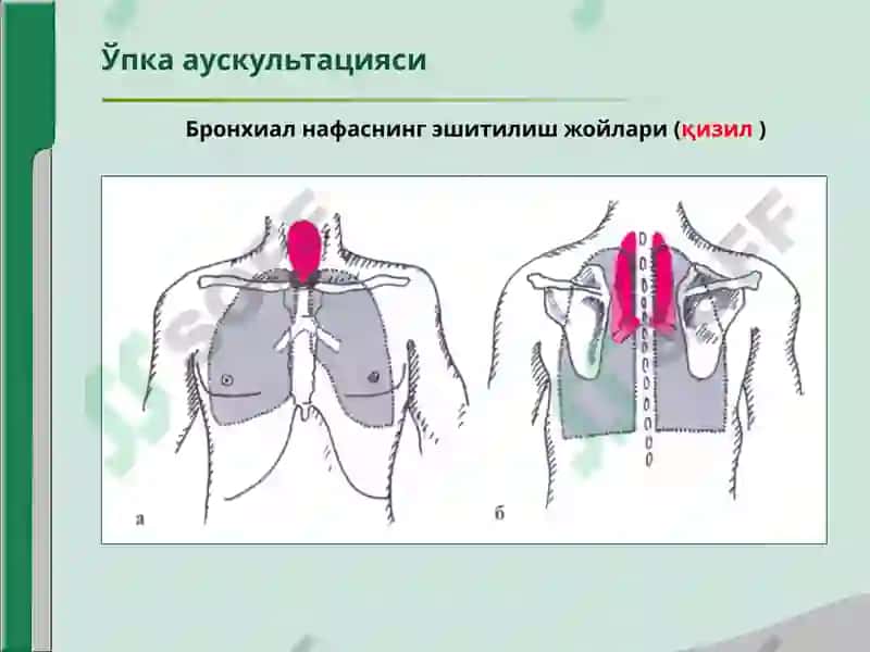 УПКА АУСКУЛЬТАЦИЯСИ 6
