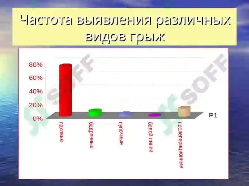 ГРЫЖИ ЖИВОТА 6