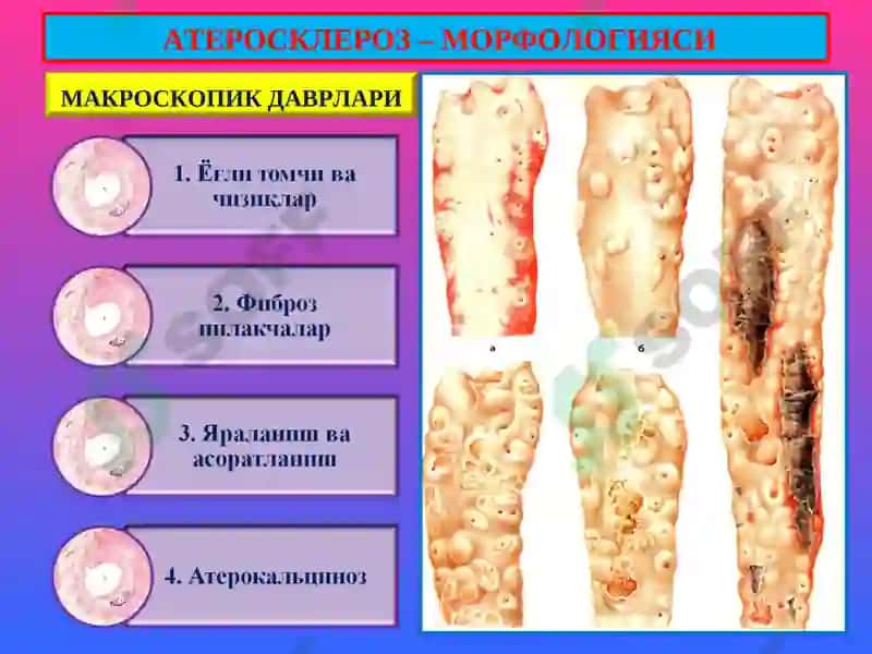 ПАТОЛОГИК АНАТОМИЯ 6