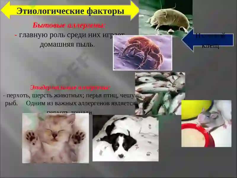 Аллергологическая диагностика 6