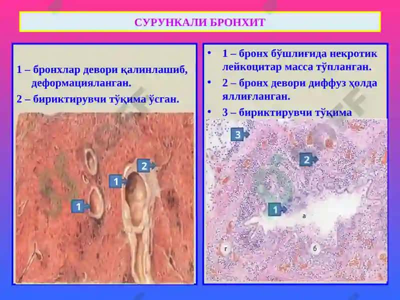 ПАТОЛОГИК АНАТОМИЯ 6