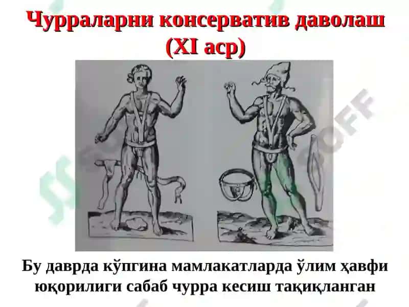 Қорин чурраларива унинг асоратлари 6