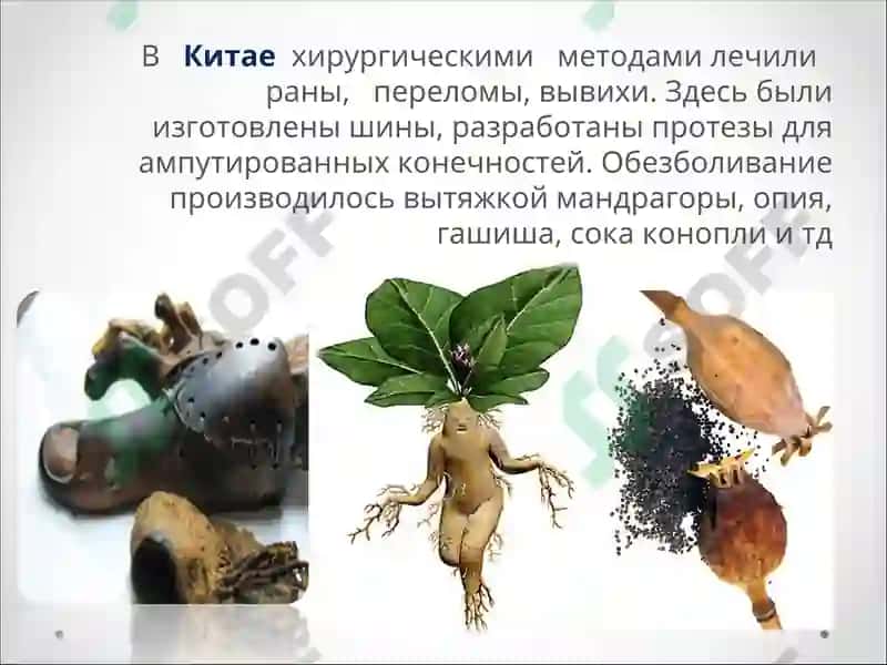 История травматологии и ортопедии в мире 6