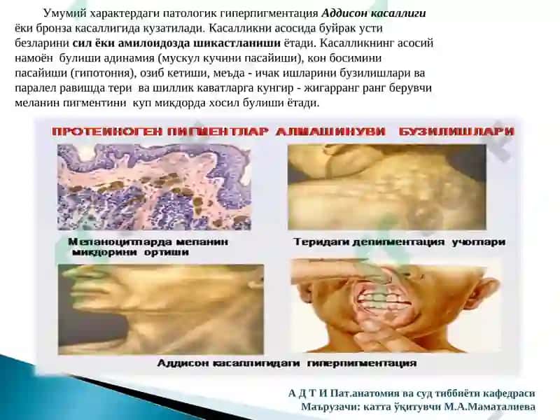Хромопротеидлар алмашинувлари 6