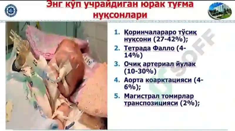 Юрак тугма нуксонлари 6