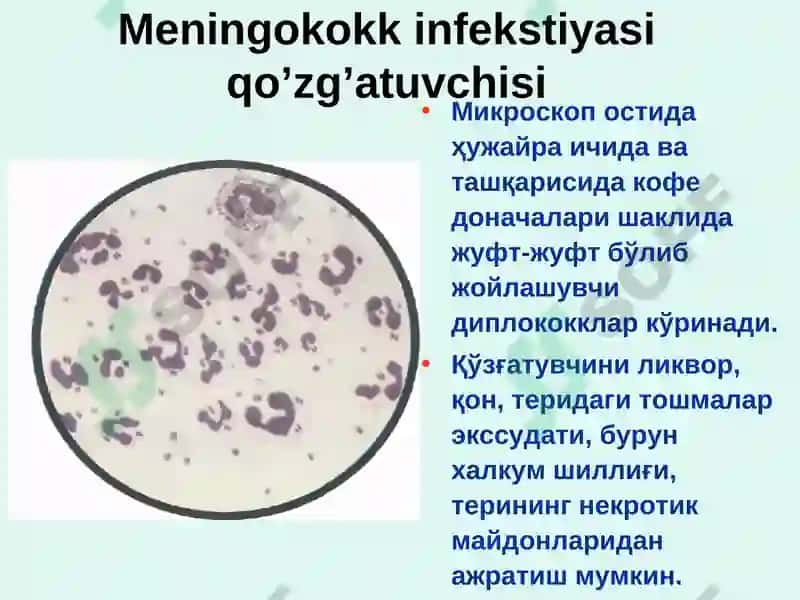 Meningokokk infekstiyasi 6