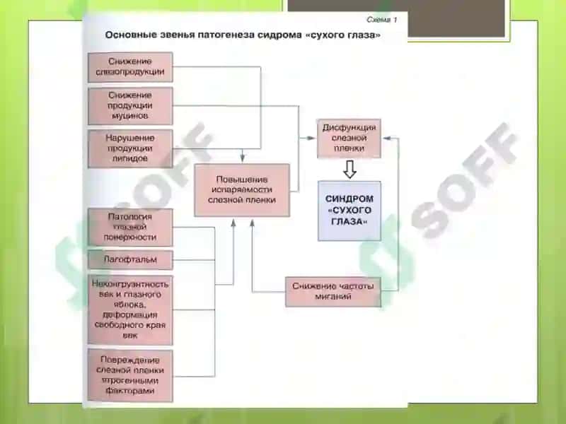Синдром сухого глаза 6