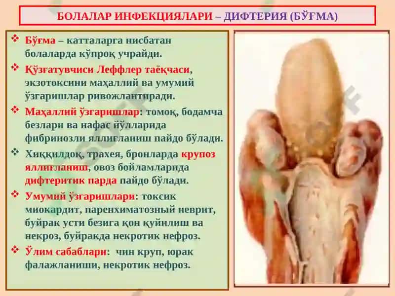 Инфекцион касалликлар 7