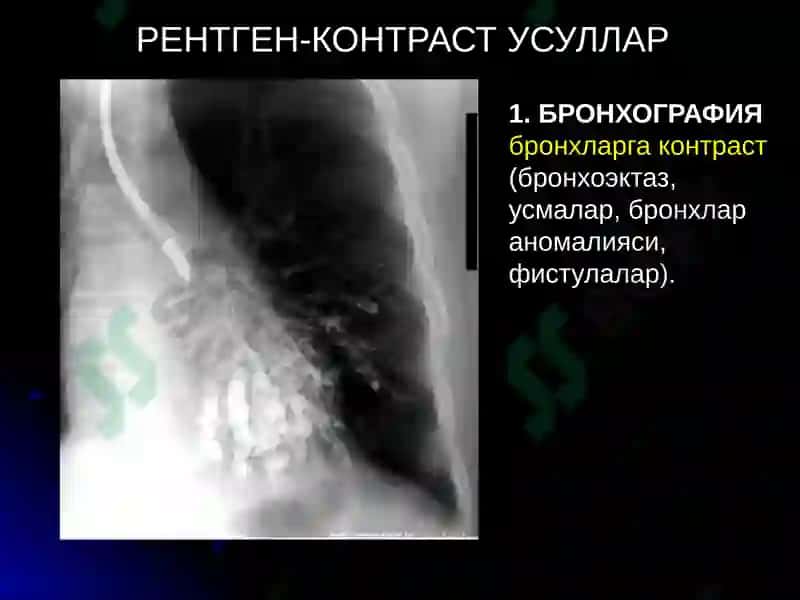 УПКА КАСАЛЛИКЛАРИНИНГ НУР ТАШХИСИ 7