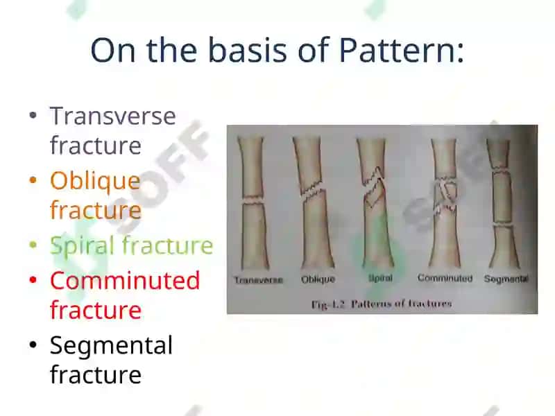 Fracture Management and Primary Care 7