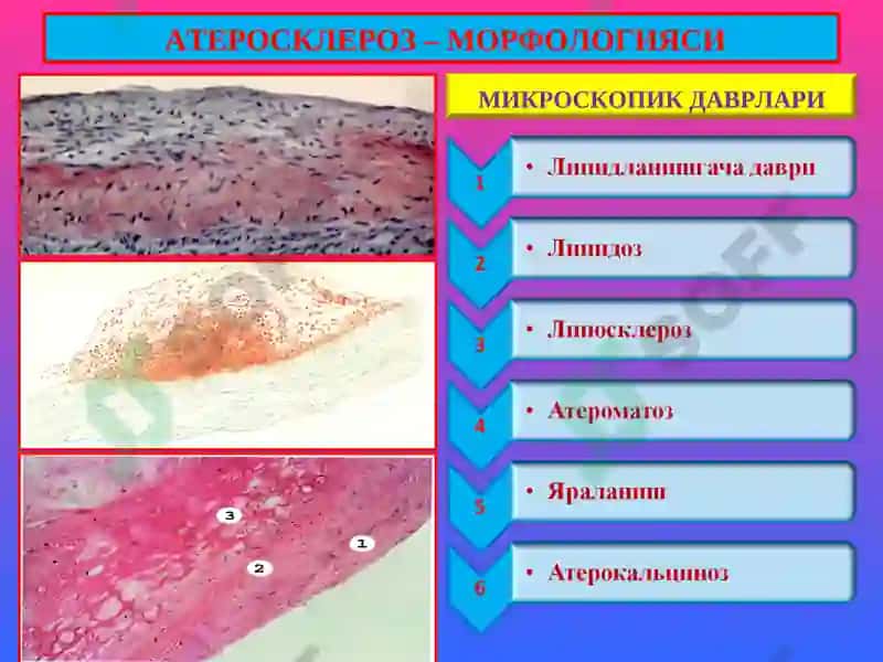 ПАТОЛОГИК АНАТОМИЯ 7