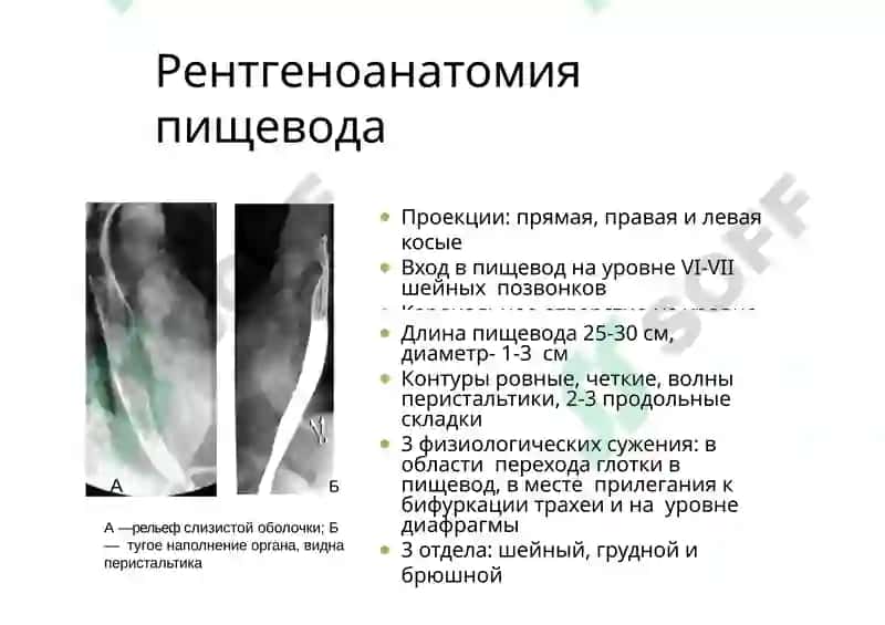 Лучевая диагностика заболеваний пищеварительной системы 7