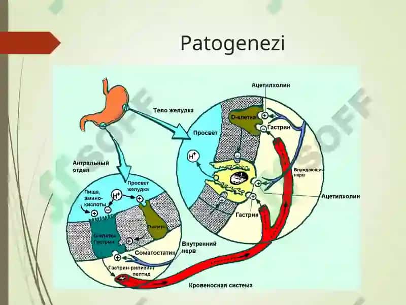 GASTRIT 7