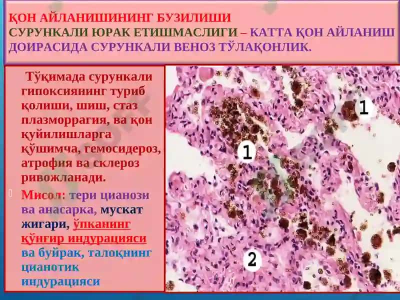 ПАТОЛОГИК АНАТОМИЯ 7