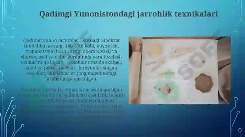 Qadimgi gretsiya va rimda jarrohlik usullari 7
