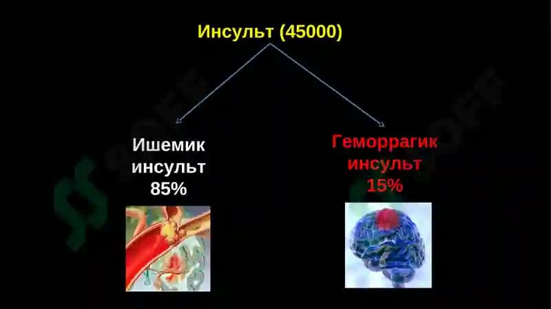 Aorta ravogi okklyuzion-stenotik kasalliklari 7