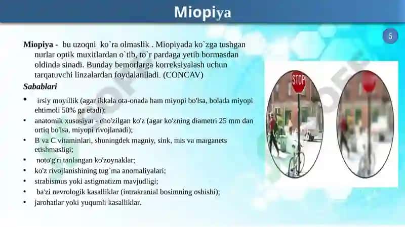 Klinik rеfraksiya 7
