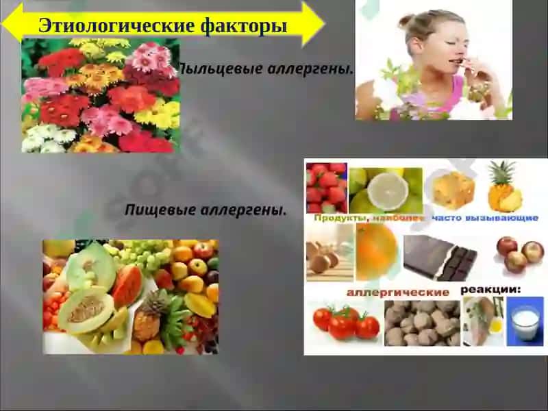 Аллергологическая диагностика 7