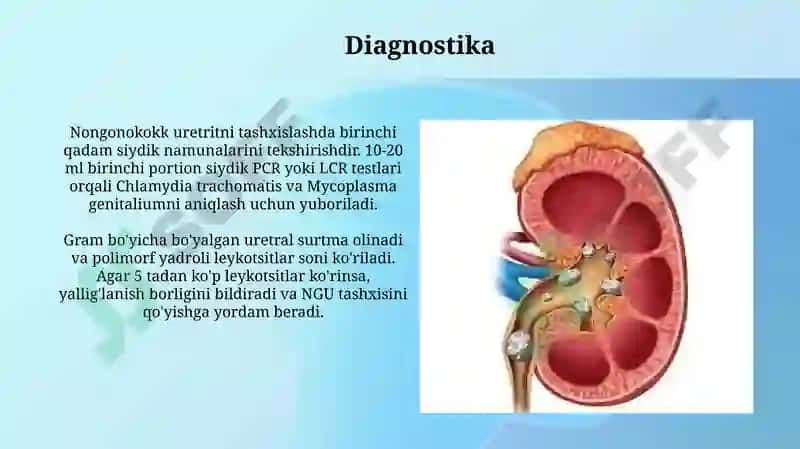 Nogonokokli uretritlar 7
