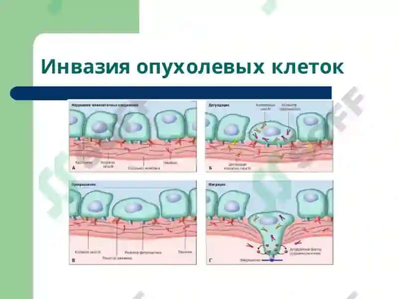 Патофизиология опухолей 7