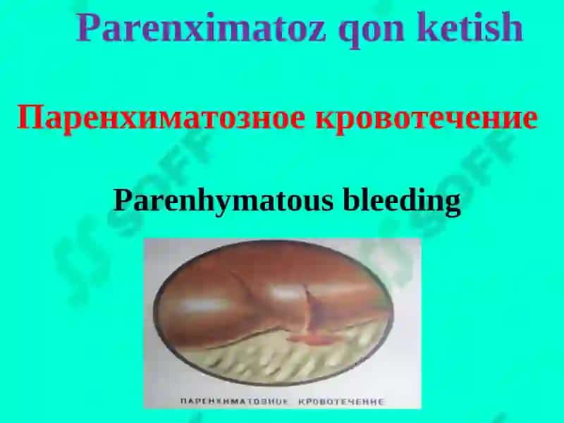 Qon ketish va uni to‘xtatish usullari 7