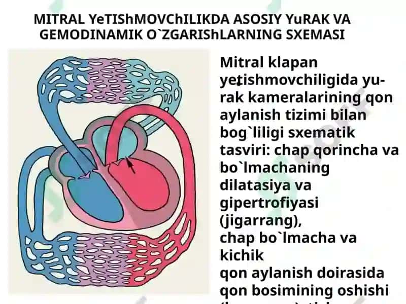 Yurak orttirilgan nuqsonlari 7