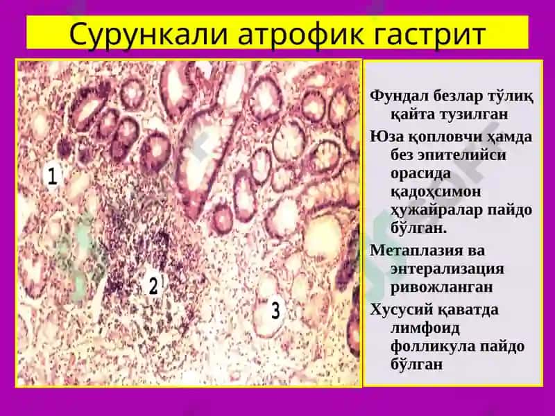 ПАТОЛОГИК АНАТОМИЯ 7