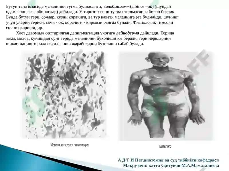 Хромопротеидлар алмашинувлари 7