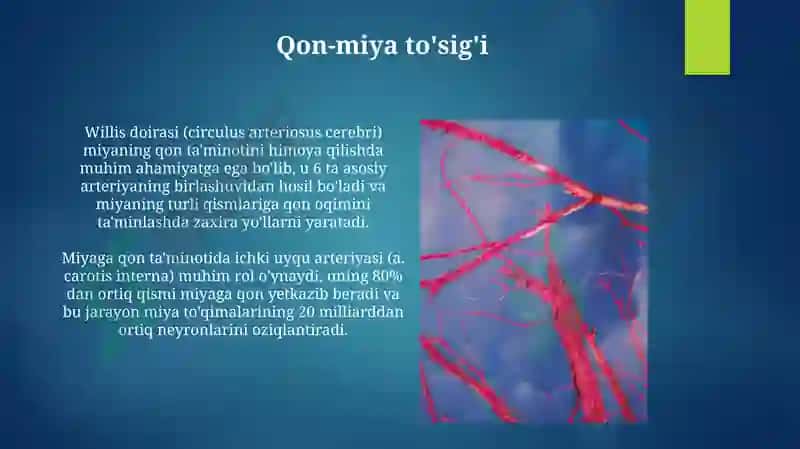 MRT angiografiyasi 8