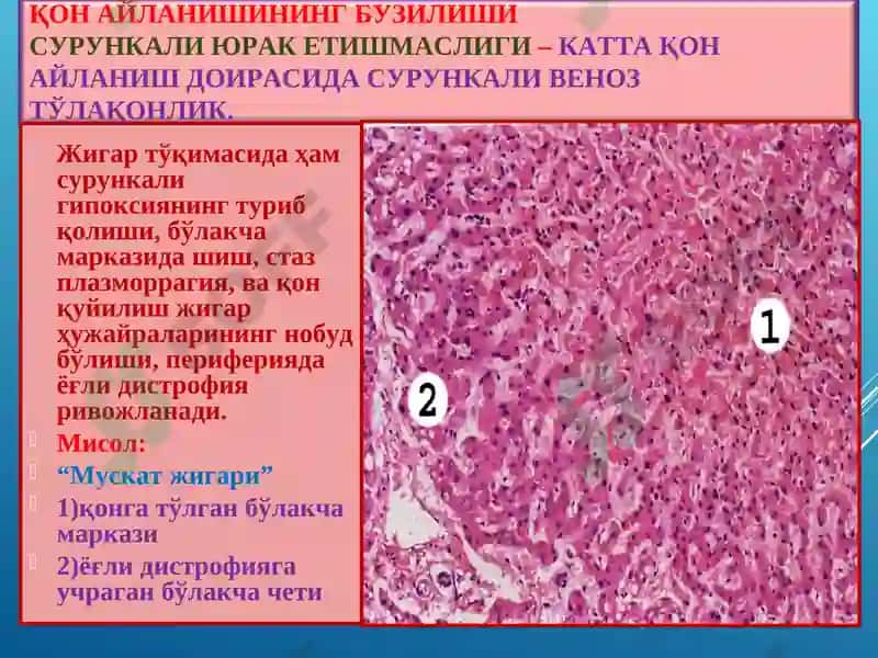 ПАТОЛОГИК АНАТОМИЯ 8