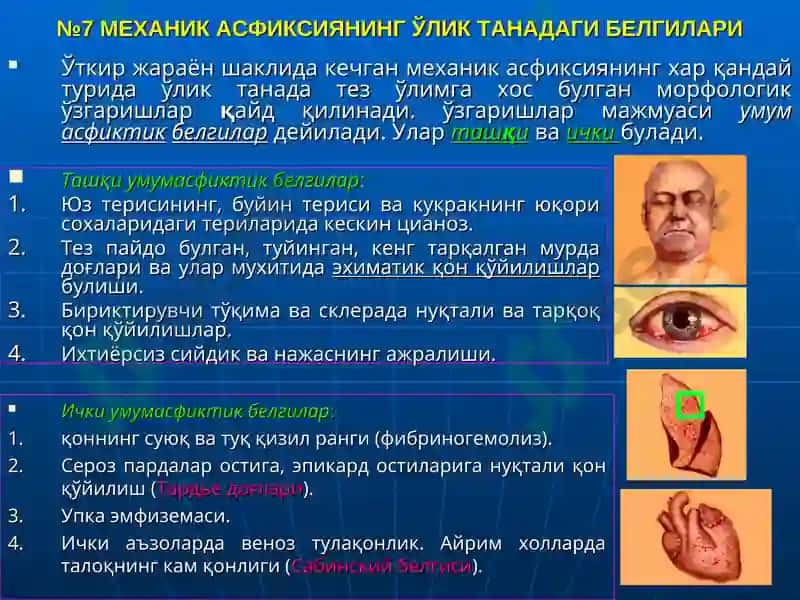 ГИПОКСИЯ ВА АСФИКСИЯ ТУШУНЧАЛАРИ 8