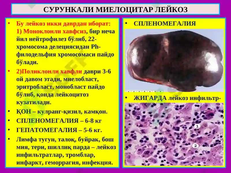 ПАТОЛОГИК АНАТОМИЯ 8