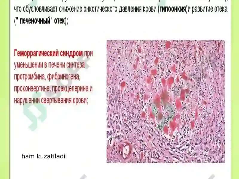 To’qima Suyuqligi Miqdorining O’zgarishi 8