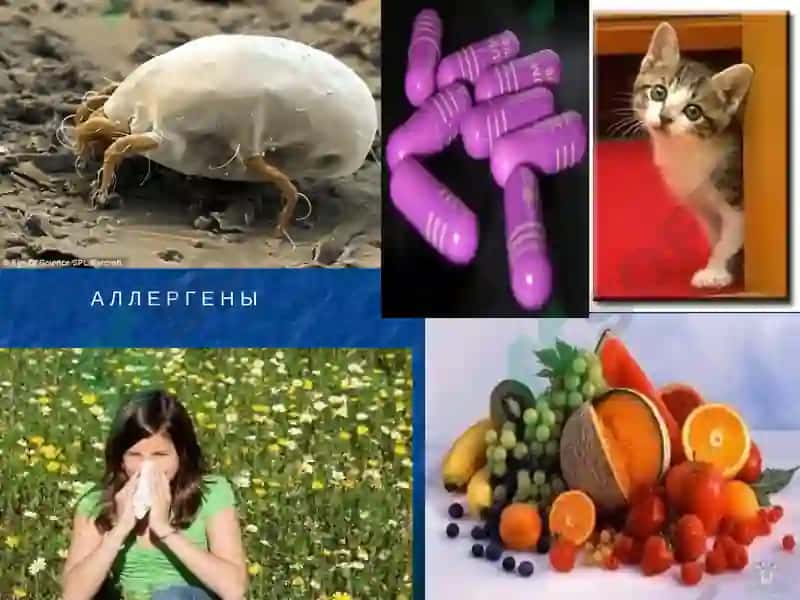 Лекция на тему: «Современные подходы диагностики и профилактики астмы» 8