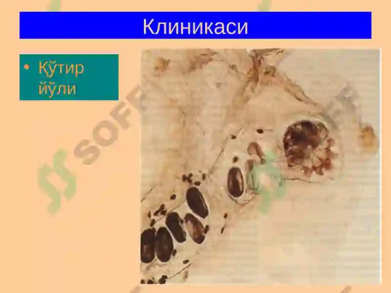Терининг Паразитар Касалликлари 8