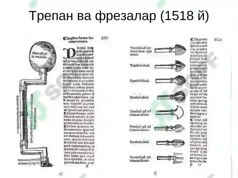 НЕЙРОХИРУРГИЯНИ РИВОЖЛАНИШ ТАРИХИ 8