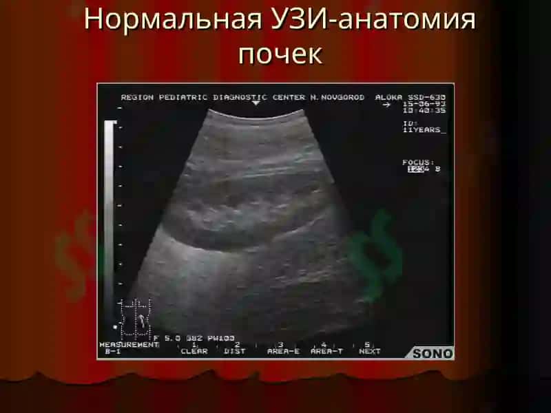 Лучевая диагностика заболеваний печени и желчевыводящих путей 8