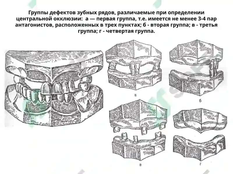 Марказий окклюзияни аниқлаш 8