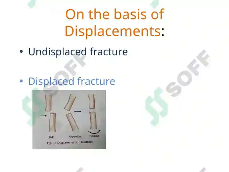 Fracture Management and Primary Care 8